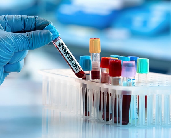 Blood Tests