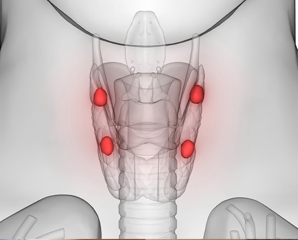Parathyroid Disease